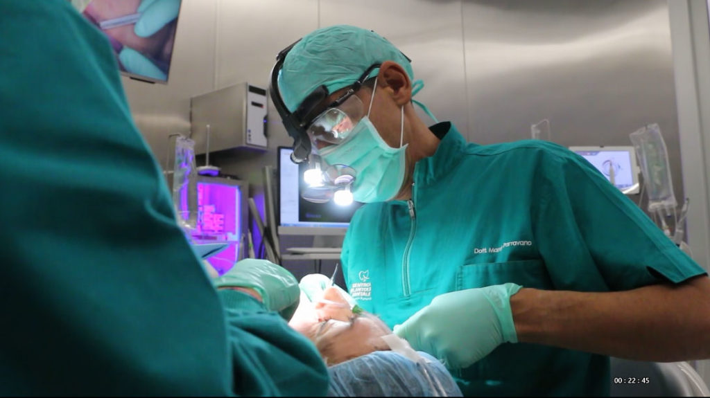 implantologia dentale pescara dottor marco parravano